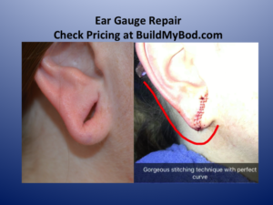 ear gauge repair